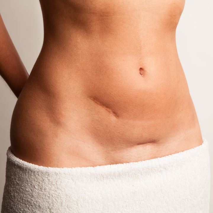 Reabilitacao Pos-Cirurgica - PHYSIO4ALL Gondomar